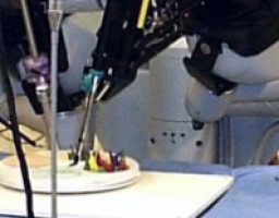 Vall d'Hebron experimenta con éxito una técnica robótica en obesidad mórbida