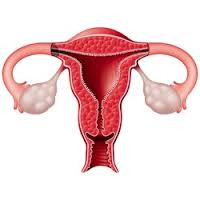 Novel way for scientists to predict chemotherapy resistance in ovarian cancer patients