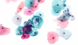 EHA 2016: Immunotherapy delivered by blinatumomab improves survival in ALL patients