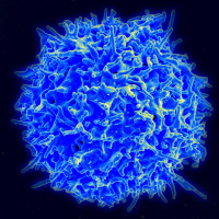 Immune cell therapy for advanced head and neck cancer helps stabilise disease