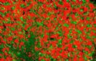 Guideline on respiratory infections in leukaemia revised