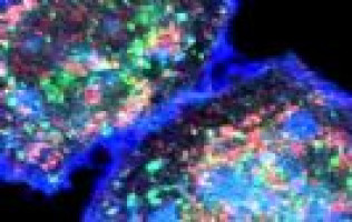 Reduction in cardiac events for prostate cancer patients with pre-existing cardiovascular disease with degarelix compared to LHRH agonists