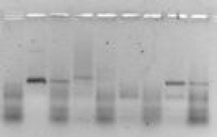 Mouse model shows that Notch activation can drive metastatic prostate cancer