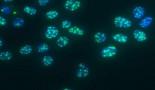 EHA 2016: Killer antibodies against AML
