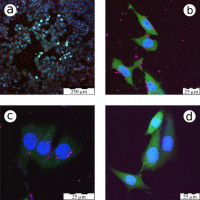 The role of fucosylation in digestive diseases and cancer