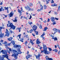 AACR 2021: Novel approach to PRMT5 inhibition that selectively targets the PRMT5/MTA complex in MTAP-deleted cancer models