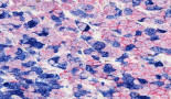 AACR 2021: Novel approach to PRMT5 inhibition that selectively targets the PRMT5/MTA complex in MTAP-deleted cancer models