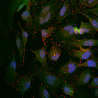 Sleep hormone helps breast cancer drug kill more cancer cells