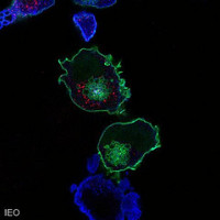 Everolimus prolongs progression-free survival for patients with neuroendocrine tumours