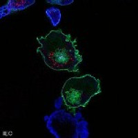 Research towards more effective treatment for multiple myeloma