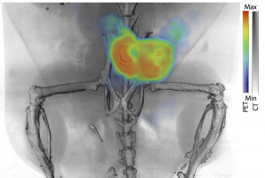New imaging method to detect, monitor and guide prostate cancer treatment