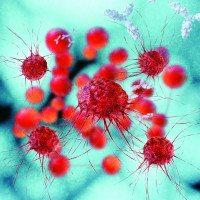 La salud mental podría afectar a las probabilidades contra el cáncer