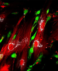 Looking beyond cancer cells to understand what makes breast cancer spread