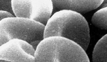 Genetic variation in East Asians found to explain resistance to cancer drugs
