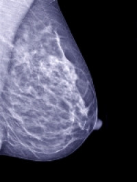 EBCC 8: Dense breasts can nearly double the risk of breast cancer recurrence 