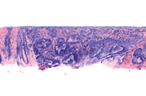 Microscope scans tumours during surgery and examines cancer biopsies in 3-D