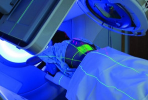 Estudio abre el camino para tratamiento de Cáncer  que puede prevenir recurrencias después radioterapia