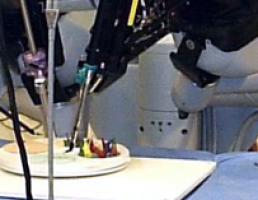 Poorest bowel cancer patients more likely to die within month of surgery