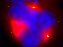 Cancer loses its sense of time to avoid stress responses