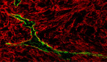 Lymphatic vessels that help cancers spread can also boost immune therapies