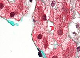 Preclinical genetic data support ongoing clinical trials testing IDO Inhibitors as a treatment for cancer