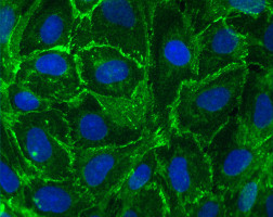 Protein key to cancer cells ability to spread is identified