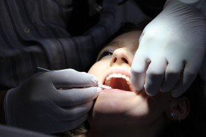More evidence of link between severe gum disease and cancer risk
