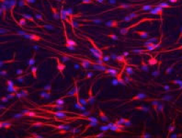 ESMO 2025: Trial results show belzutifan shrinks rare neuroendocrine tumours and improves symptoms
