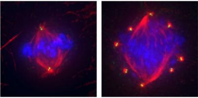Centriole concentration increased in aggressive cancer cells