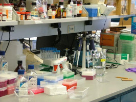 Advancing biomedical diagnostics: Compact photoacoustic sensing instrument for breast tissue characterisation