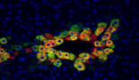 Aramchol boosts regorafenib effectiveness in gastrointestinal tumours