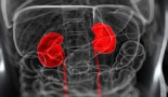 Plasma neutrophil gelatinase-associated lipocalin and factors related to acute kidney injury and mortality in critically ill cancer patients