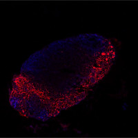 ESMO 2025: Study finds COVID-19 mRNA vaccine sparks immune response to fight cancer