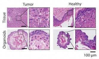 Circulating tumour cell-derived organoids: Unveiling mechanisms of tumour metastasis and establishing a new platform for precision therapy