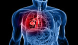 Adding immunotherapy after initial treatment can benefit metastatic lung cancer patients