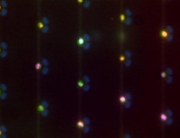 Microfluidic array catches, holds single cervical cells for faster screening