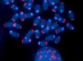 Traces of immortality in tumor DNA