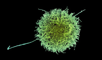 Turbocharging the body's natural killer cells to defeat cancer