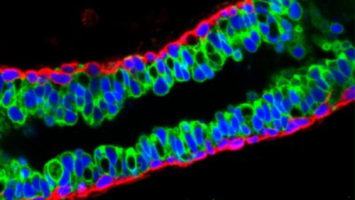 SRC-3 is a novel regulator of human immune T regulatory cells
