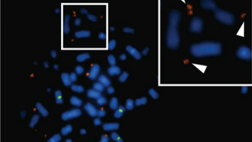 Non-coding DNA located outside chromosomes may help drive glioblastoma