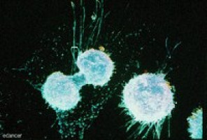 Ovarian cancer stem cell study puts targeted therapies within reach