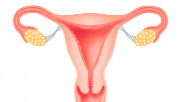 New study discovers possible early detection method for elusive ovarian cancer