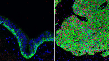 Researchers discover new compound that promotes lung health