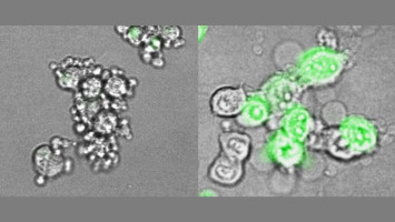 Gasdermin E: A new approach to cancer immunotherapy that could have broad reach