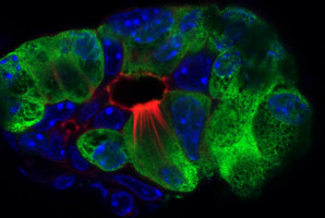 Mysterious tuft cells found to play role in pancreatitis