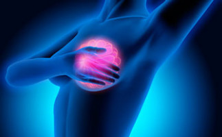 ASCO 2020: El Pembrolizumab más la quimioterapia demostró una mejoría en el SFP en pacientes con cáncer de mama metastásico triple negativo