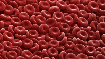 ASCO 2020: Terapia de combinación bien tolerada y altamente efectiva para pacientes con LMA con mutación IDH1