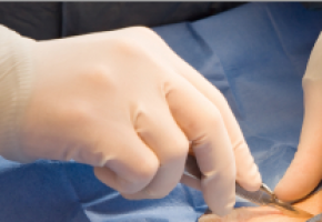 AACR 2020: Los datos del mundo real muestran que la inmunoterapia después de la cirugía de melanoma produce beneficios de supervivencia