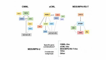 Identified the genetic landscape of myelodysplastic/myeloproliferative neoplasms