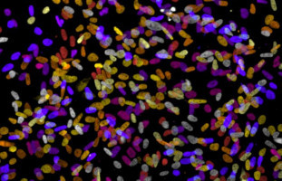 La pérdida de células caliciformes intestinales causa una enfermedad mortal después del trasplante de células madre